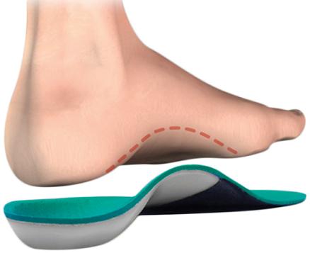 Insoles For Flat Feet Are Amazing